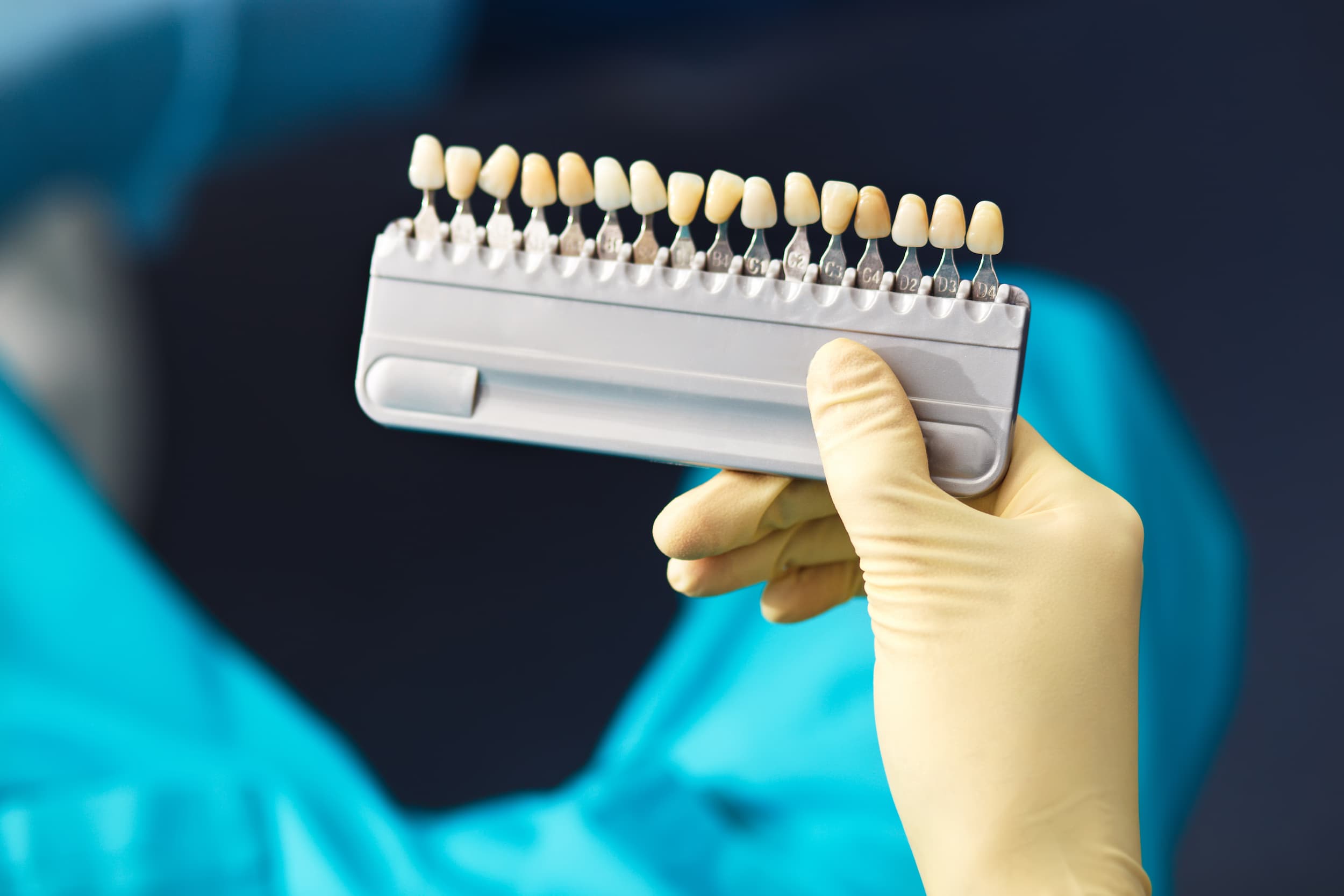 Dentist holding tooth shade guide for selecting colour of dental veneers