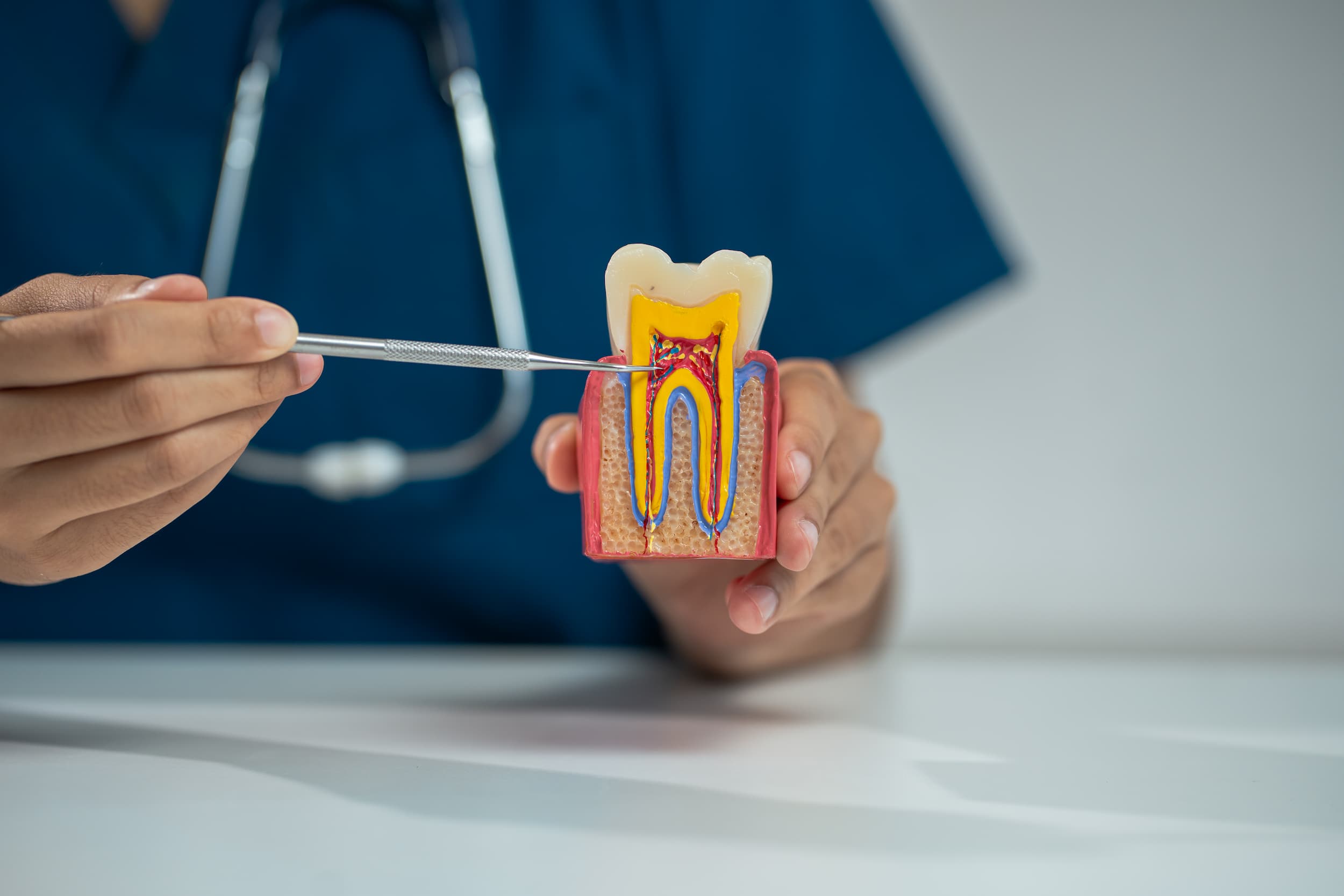 Dentist explaining root canal treatment using tooth model at Exquisite Smiles Warner