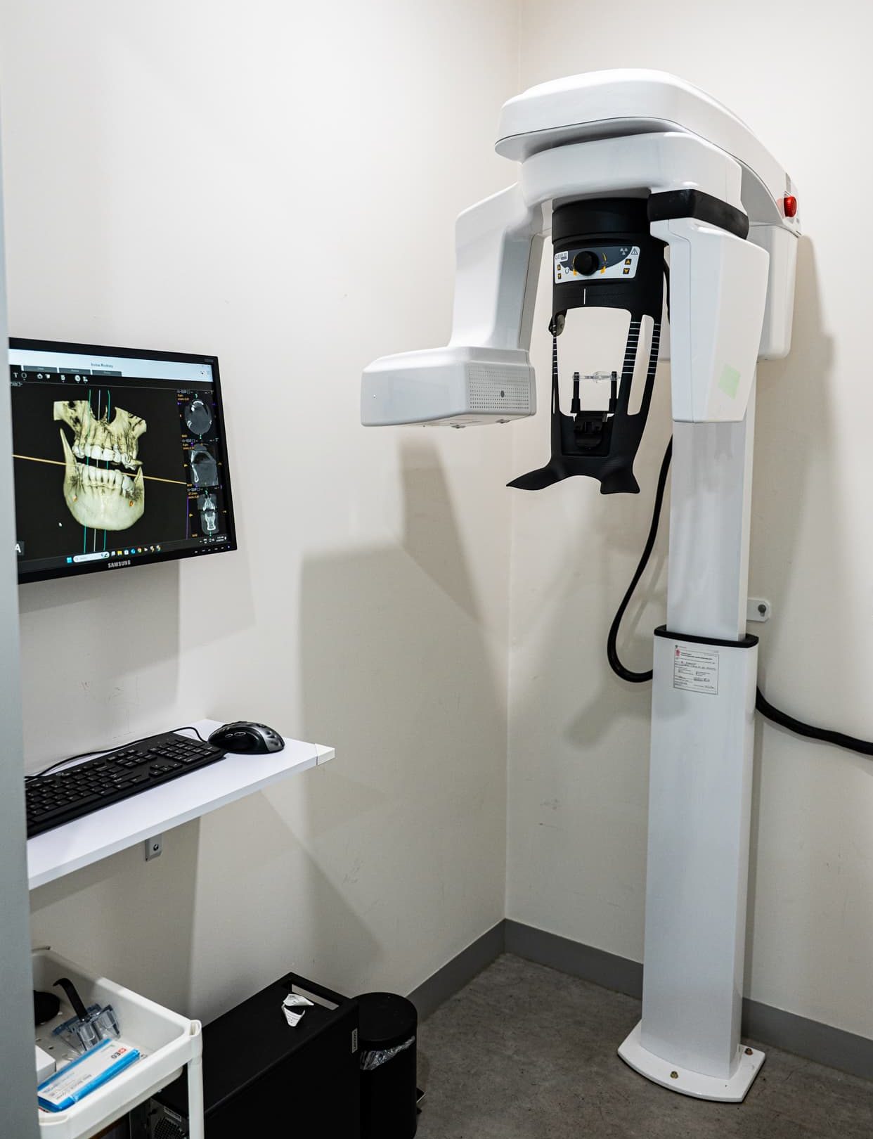 3D dental CBCT scanner used for precise implant planning and advanced dental diagnostics.