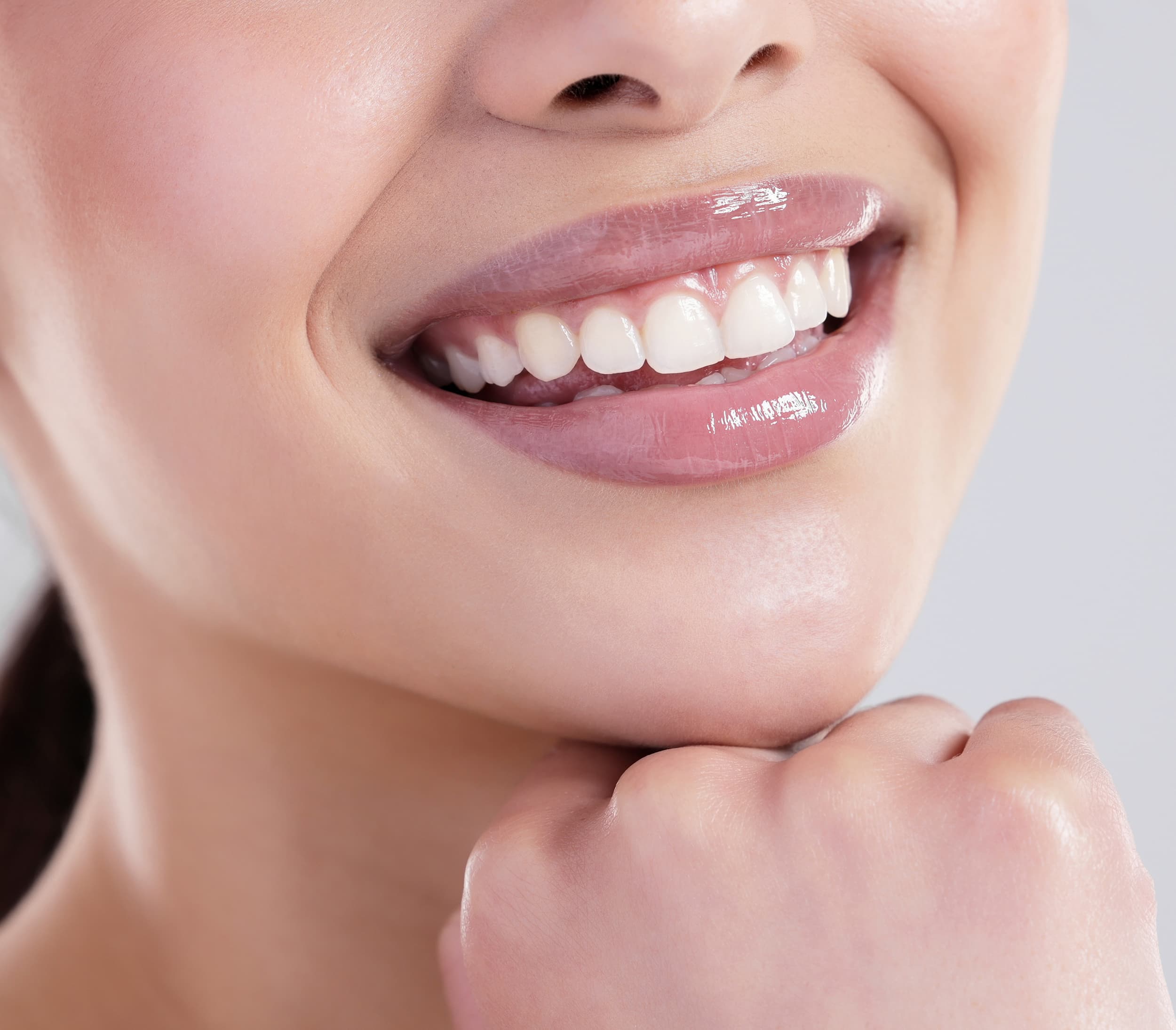 Smile design showcasing healthy, straight, natural-looking white teeth and balanced gums.