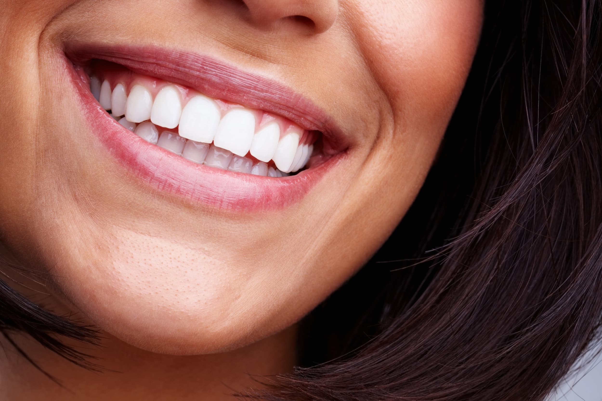 Woman smiling showing white teeth
